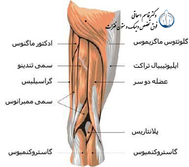 عضلات همسترینگ Hamstring muscle